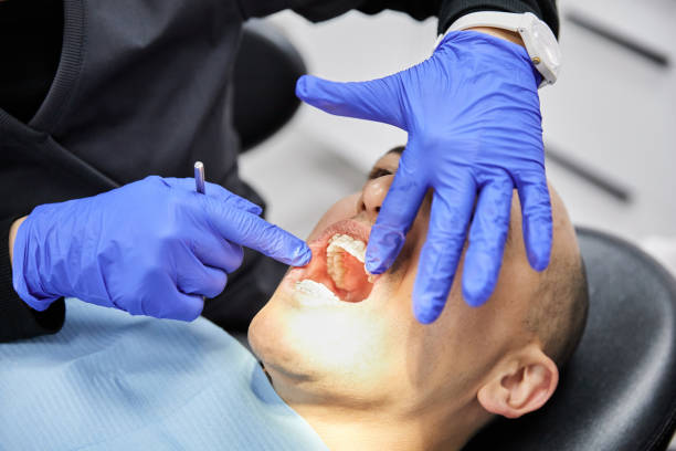 Best Emergency Broken Tooth Repair in South Russell, OH